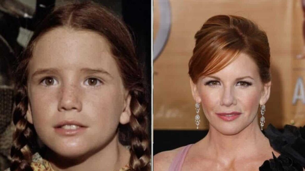 Melissa Gilbert’s Natural Beauty: Botox and Implant-Free