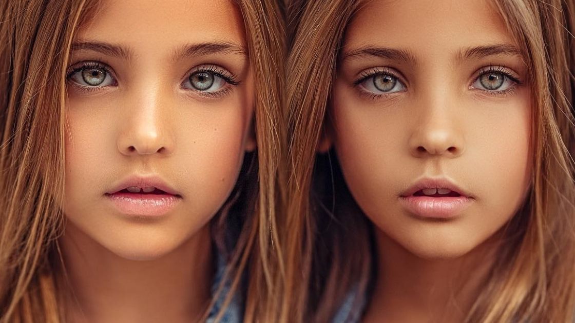 The World’s Most Beautiful Twins 12 Years Later – Take a Look at Them Now